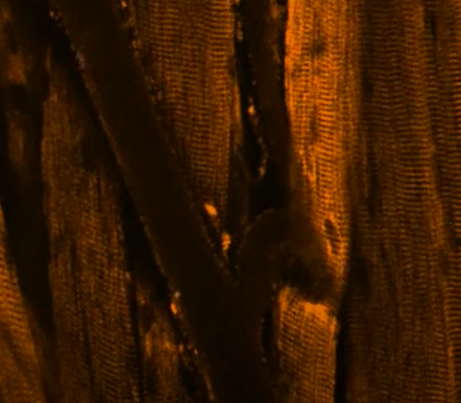 Prof. Othman's Lab -
Click below to watch videos of an Intravital Microscopy showing clot formation in the PT-VWD mouse model wild type (hTgWT) and mutant mouse (hTgG233V) (Thromb Haemost 2017; 117(03): 543-555)
Wild Type Mutant Mutant+Inhibitor